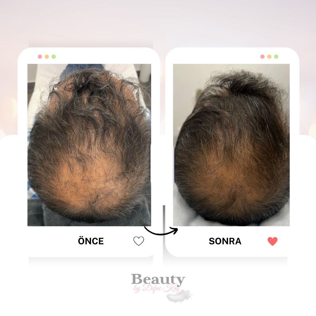 Saç bakım protokolü — Alanya Beauty by Defne